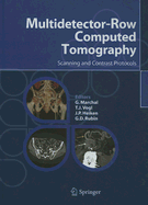 Multidetector-Row Computed Tomography: Scanning and Contrast Protocols