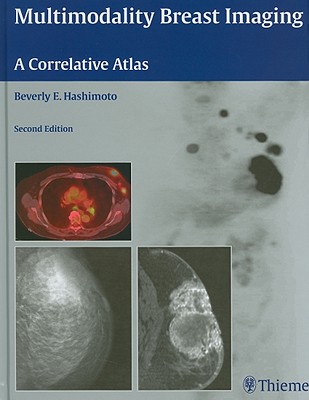 Multimodality Breast Imaging: A Correlative Atlas - Hashimoto, Beverly