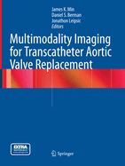 Multimodality Imaging for Transcatheter Aortic Valve Replacement