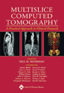 Multislice Computed Tomography: Principles, Practice, and Clinical Protocols