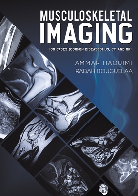 Musculoskeletal Imaging: 100 Cases (Common Diseases) US, CT and MRI - Haouimi, Ammar, and Bouguelaa, Rabah