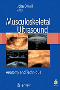 Musculoskeletal Ultrasound: Anatomy and Technique - O'Neill, John M D (Editor)