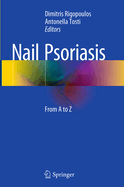 Nail Psoriasis: From A to Z