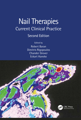 Nail Therapies: Current Clinical Practice - Baran, Robert (Editor), and Rigopoulos, Dimitris (Editor), and Grover, Chander (Editor)