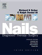 Nails: Diagnosis, Therapy, Surgery