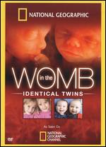 National Geographic: In the Womb - Identical Twins - Lorne Townend