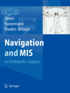 Navigation and MIS in Orthopedic Surgery