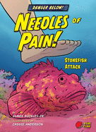 Needles of Pain!: Stonefish Attack