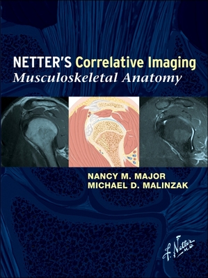 Netter's Correlative Imaging: Musculoskeletal Anatomy - Major, Nancy M, MD, and Malinzak, Michael D, MD, PhD