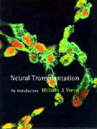 Neural Transplantation: An Introduction