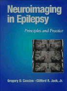 Neuroimaging in Epilepsy: Principles & Practice