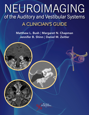 Neuroimaging of the Auditory and Vestibular Systems: A Clinician's Guide - Bush, Matthew L., and Chapman, Margaret N., and Shinn, Jennifer B.