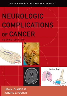 Neurologic Complications of Cancer - Deangelis, Lisa M, and Posner, Jerome B, MD