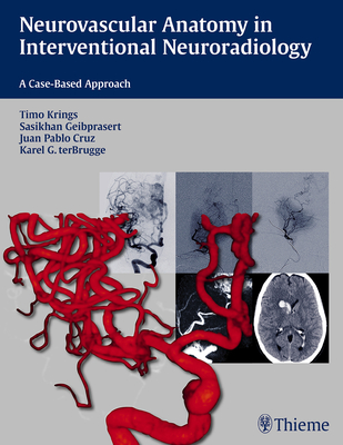 Neurovascular Anatomy in Interventional Neuroradiology: A Case-Based Approach - Krings, Timo, and Geibprasert, Sasikhan, and Cruz, Juan Pablo