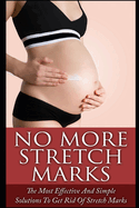 No More Stretch Marks: The Most Effective and Simple Solutions to Get Rid of Stretch Marks