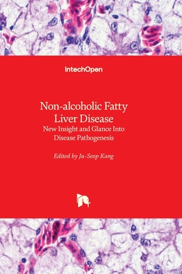 Non-alcoholic Fatty Liver Disease: New Insight and Glance Into Disease Pathogenesis - Kang, Ju-Seop (Editor)