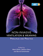 Non-Invasive Ventilation and Weaning Principles and Practive