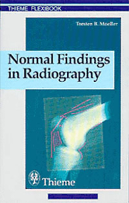 Normal Findings in Radiography - Moeller, Torsten Bert
