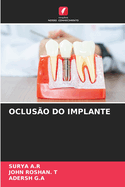 Oclus?o Do Implante