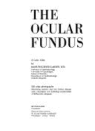 Ocular Fundus: A Color Atlas - Larsen, Hans Walther