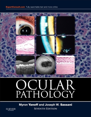 Ocular Pathology - Yanoff, Myron, MD, and Sassani, Joseph W, MD, Mha