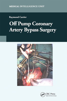 Off-Pump Coronary Artery Bypass Surgery - Cartier, Raymond