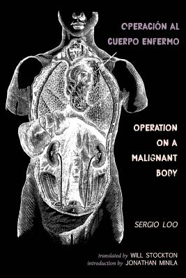 Operaci?n al Cuerpo Enfermo / Operation on a Malignant Body - Loo, Sergio, and Stockton, Will (Translated by), and Minila, Jonathan (Introduction by)