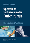 Operationstechniken in Der Fu?chirurgie: Eine Praktische Op-Anleitung