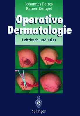 Operative Dermatologie: Lehrbuch Und Atlas - Petres, Johannes, and Rompel, Rainer