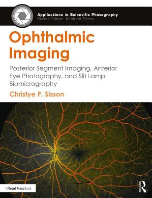 Ophthalmic Imaging: Posterior Segment Imaging, Anterior Eye Photography, and Slit Lamp Biomicrography - Sisson, Christye