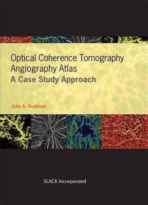 Optical Coherence Tomography Angiography Atlas: A Case Study Approach - Rodman, Julie, and Esmaili, Dan