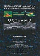 Optical Coherence Tomography in Age-Related Macular Degeneration