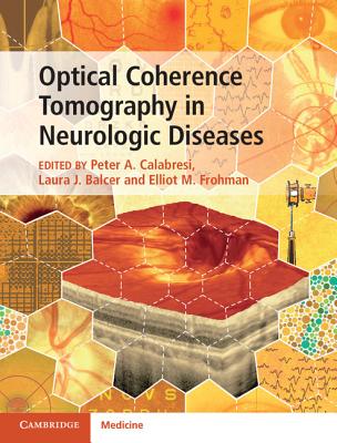 Optical Coherence Tomography in Neurologic Diseases - Calabresi, Peter A (Editor), and Balcer, Laura J (Editor), and Frohman, Elliot M (Editor)