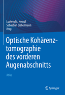 Optische Koharenztomographie Des Vorderen Augenabschnitts: Atlas