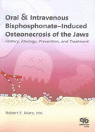 Oral and Intravenous Bisphosphonate-Induced Osteonecrosis of the Jaws: History, Etiology, Prevention, and Treatment