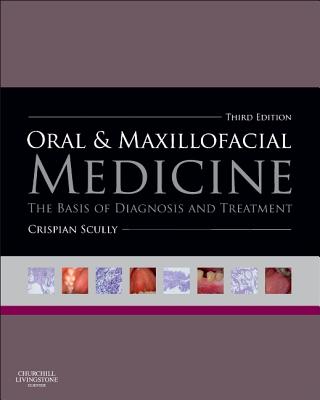 Oral and Maxillofacial Medicine: The Basis of Diagnosis and Treatment - Scully, Crispian