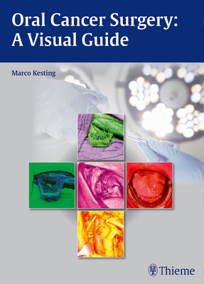 Oral Cancer Surgery: A Visual Guide - Kesting, Marco