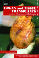 Organ and Tissue Transplants: Medical Miracles and Challenges