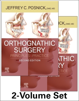 Orthognathic Surgery - 2 Volume Set: Principles and Practice - Posnick, Jeffrey C, DMD, MD, Facs