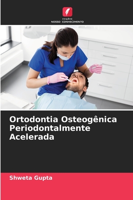 Ortodontia Osteog?nica Periodontalmente Acelerada - Gupta, Shweta
