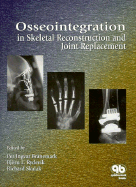 Osseointegration in Skeletal Reconstruction and Joint Replacement