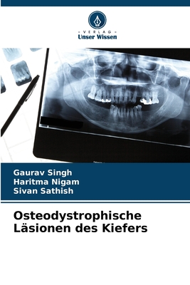 Osteodystrophische L?sionen des Kiefers - Singh, Gaurav, and Nigam, Haritma, and Sathish, Sivan