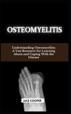Osteomyelitis: Understanding Osteomyelitis: A Vast Resource for Learning About and Coping With the Disease - Cooper, Jace