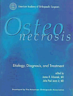 Osteonecrosis: Etiology, Diagnosis, and Treatment - Urbaniak, James R (Editor), and American Orthopaedic Association, and Jones, John P (Editor)