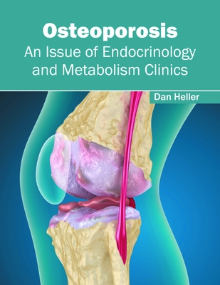 Osteoporosis: An Issue of Endocrinology and Metabolism Clinics - Heller, Dan (Editor)