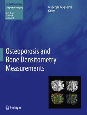 Osteoporosis and Bone Densitometry Measurements - Guglielmi, Giuseppe (Editor)