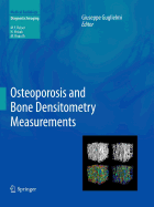 Osteoporosis and Bone Densitometry Measurements