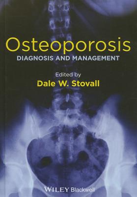 Osteoporosis: Diagnosis and Management - Stovall, Dale W. (Editor)