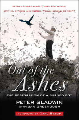 Out of the Ashes: The restoration of a burned boy - Gladwin, Peter, and Greenough, Jan