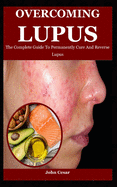 Overcoming Lupus: The Complete Guide To Permanently Cure And Reverse Lupus